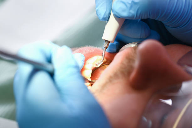 Best Emergency Care for Gum Disease in Dranesville, VA