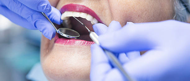 Best Knocked-Out Tooth (Avulsed Tooth) Treatment in Dranesville, VA